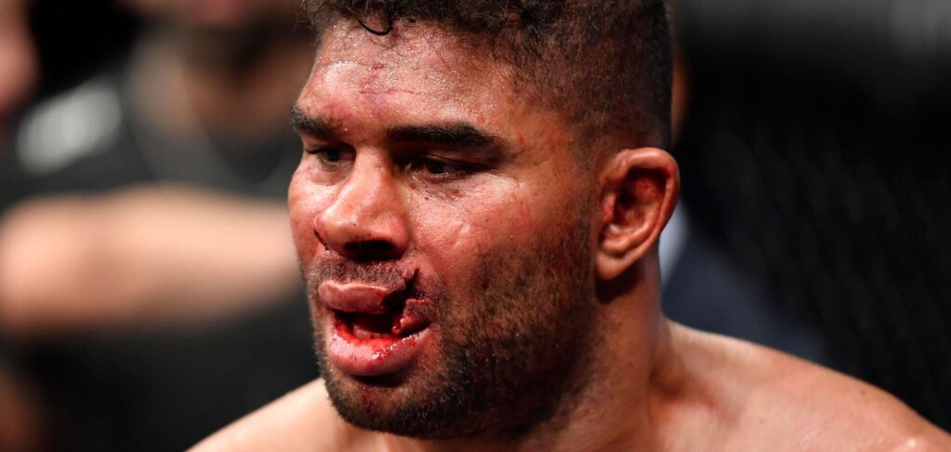 Боец UFC получил чудовищную травму на последней секунде боя: фото и видео 18+