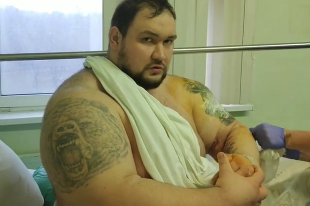 212-килограммовому бойцу ММА оторвали бицепс в поединке