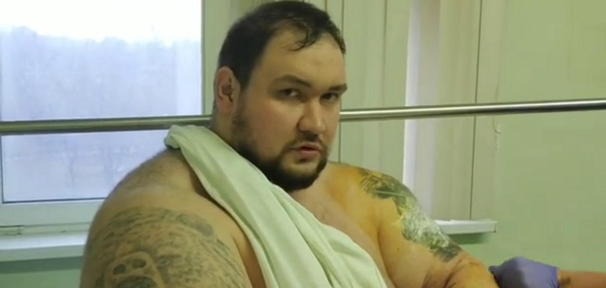 212-килограммовому бойцу ММА оторвали бицепс в поединке