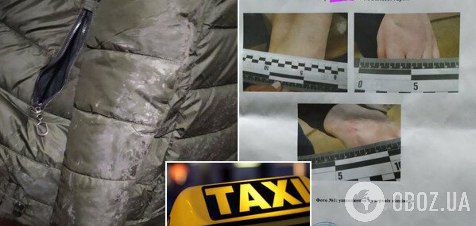 Выбросил из машины и бил ногами: в Днепре таксист жестоко расправился с девушкой