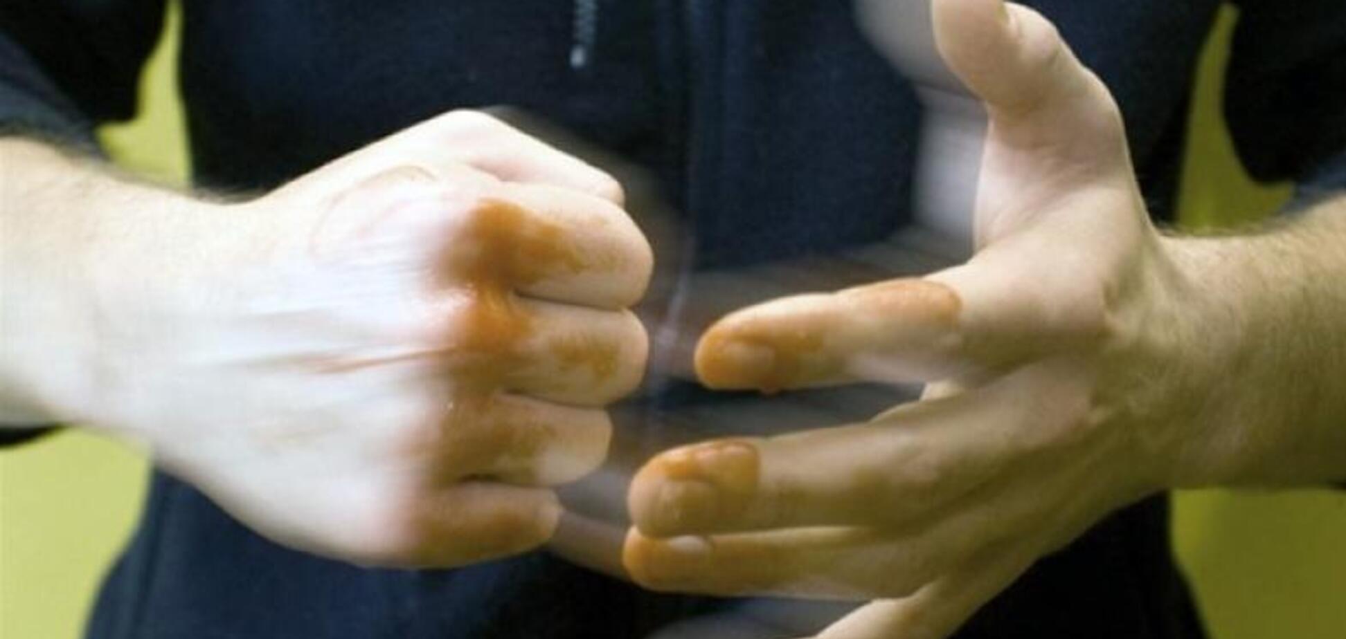 Стены залиты кровью: в общежитии Днепра пьяный студент устроил ЧП