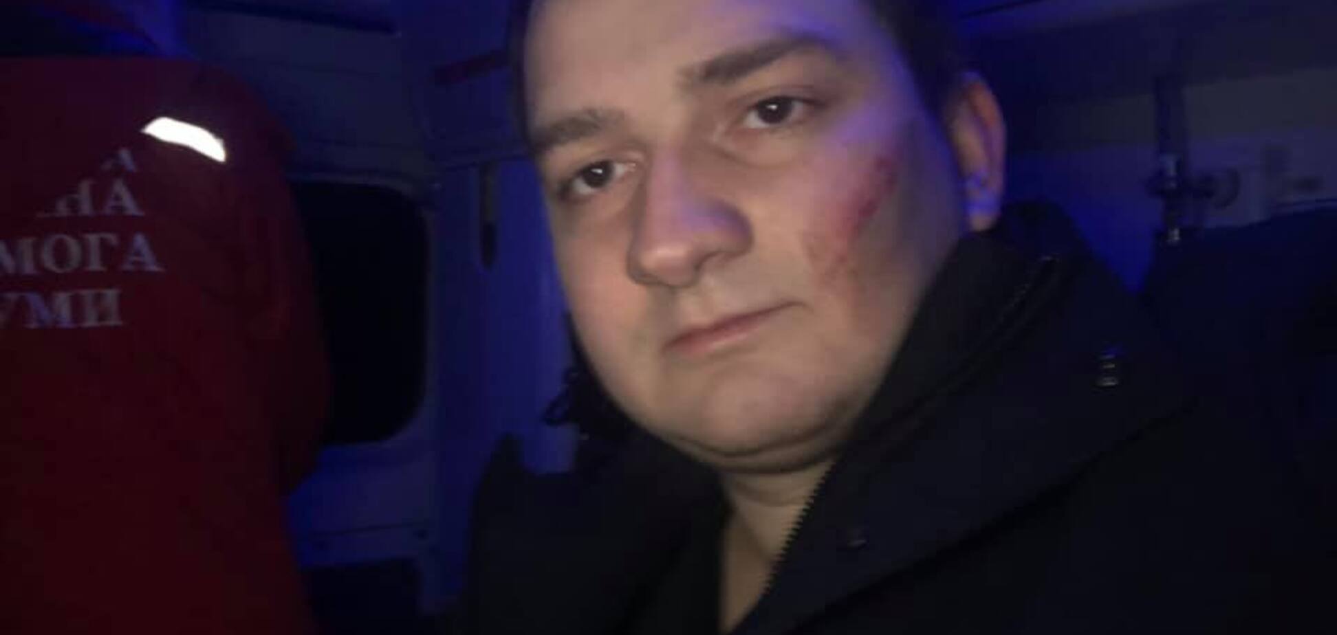 'Много вопросов': генерал СБУ указал на странности в нападении на 'слугу народа'