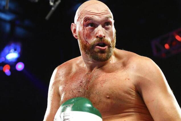 Тайсон Фьюри