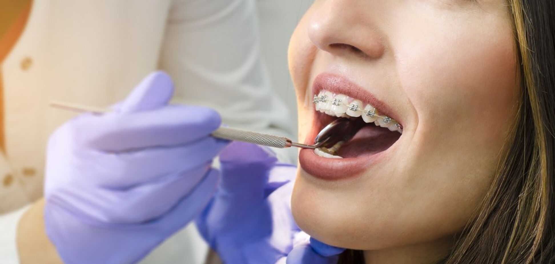 Ортодонтичне лікування в Добробут