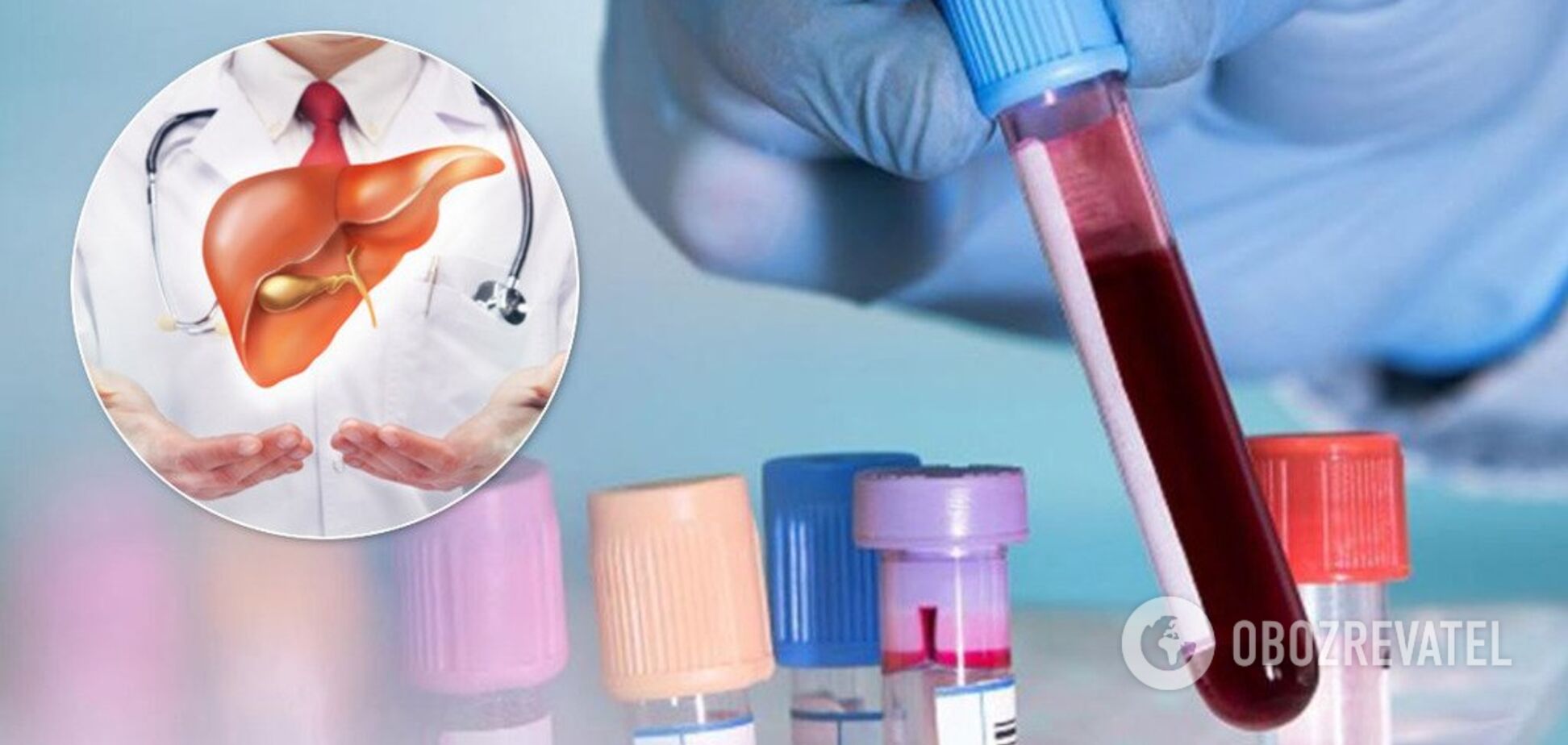 Біохімічний аналіз крові: про що 'говорять' печінкові проби