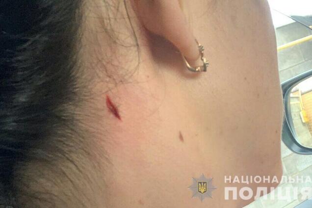 Женщина утверждает, что получила ранения шеи во время учебных стрельб полицейских