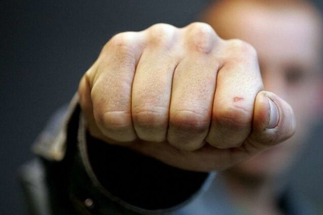 Под Одессой пьяный водитель побил полицейского