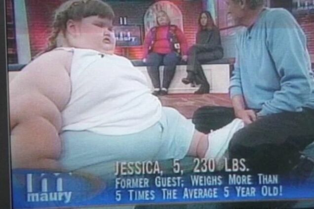 Самая толстая девочка в мире сбросила 145 кг: удивительная история и фото