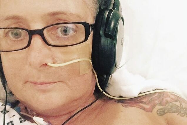 У жінки 'облізла' шкіра після пластичної операції: моторошні фото