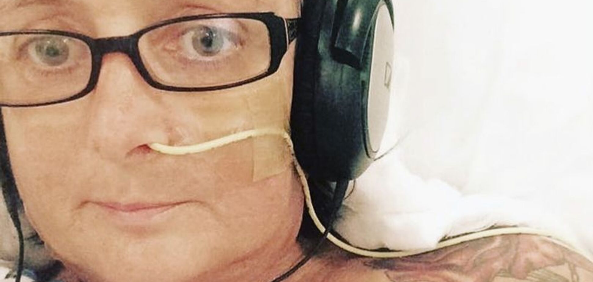 У жінки 'облізла' шкіра після пластичної операції: моторошні фото