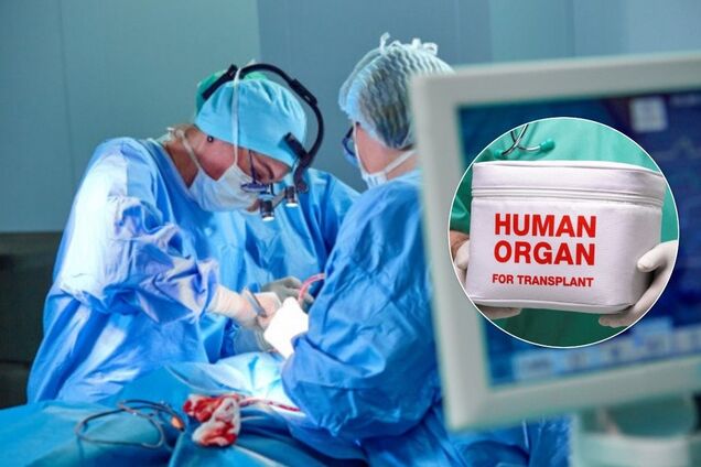 Украинцам разрешат пересаживать органы: чего ждать от кардинального решения Рады
