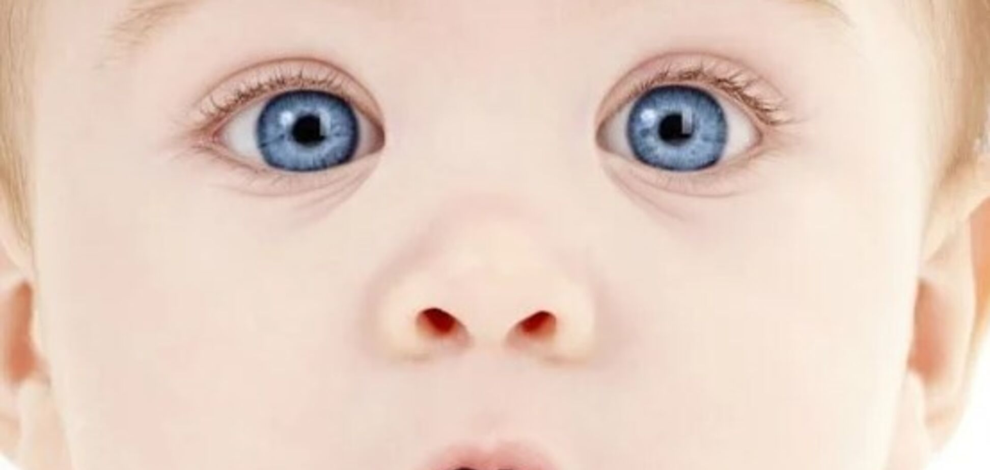 Глаукома у дітей: лікар назвав основні ознаки хвороби