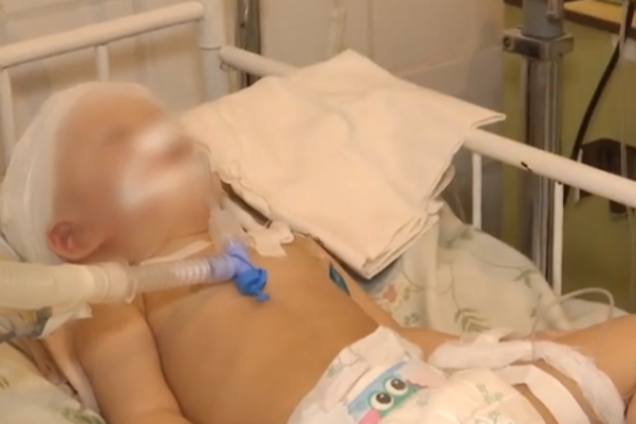 'Трижды останавливалось сердце': Херсонщину всколыхнула история с избитой малышкой