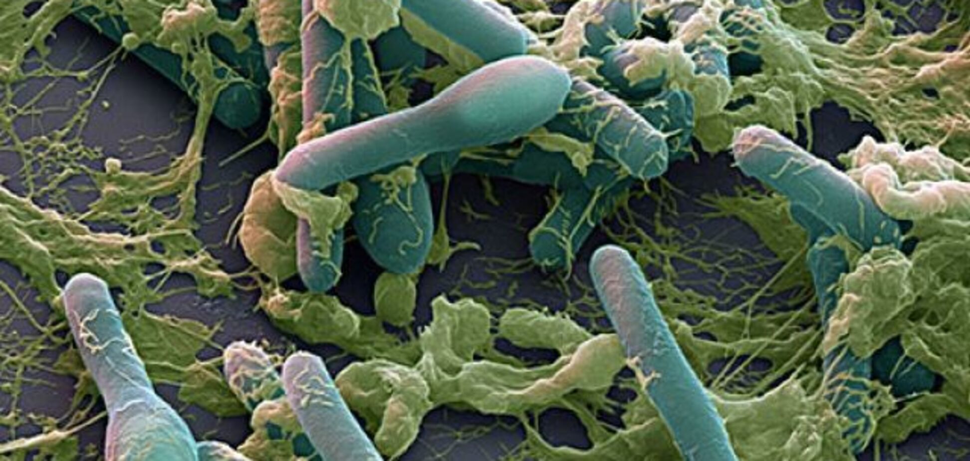 Ели консервы: в Киеве два человека заразились смертельной инфекцией