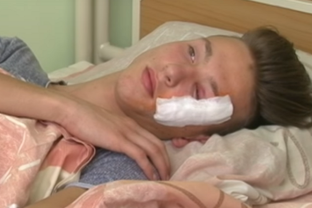 Проломил голову топором: в Кропивницком отец школьницы устроил кровавую расправу над ее парнем