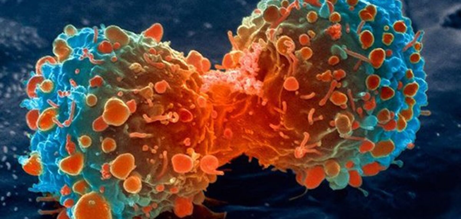 Как спастись от рака: назван простой способ
