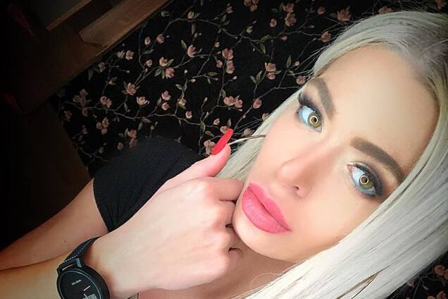 ''Ніс став у три рази більшим!'' Зірці ''Дому-2'' понівечили обличчя