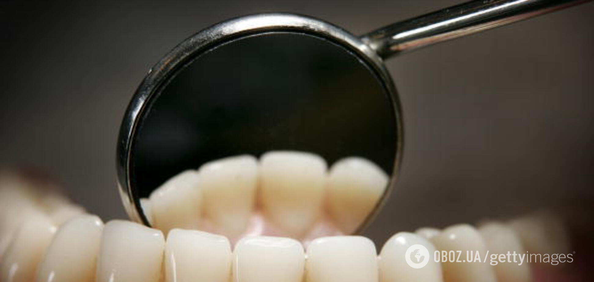 Самая опасная болезнь: врач рассказал о новой угрозе зубам украинцев
