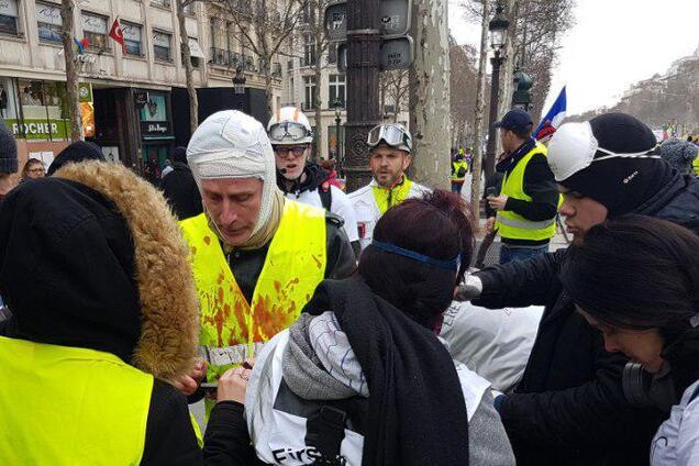 Оторванные руки, разбитые головы: в Париже полиция взялась за ''желтые жилеты''