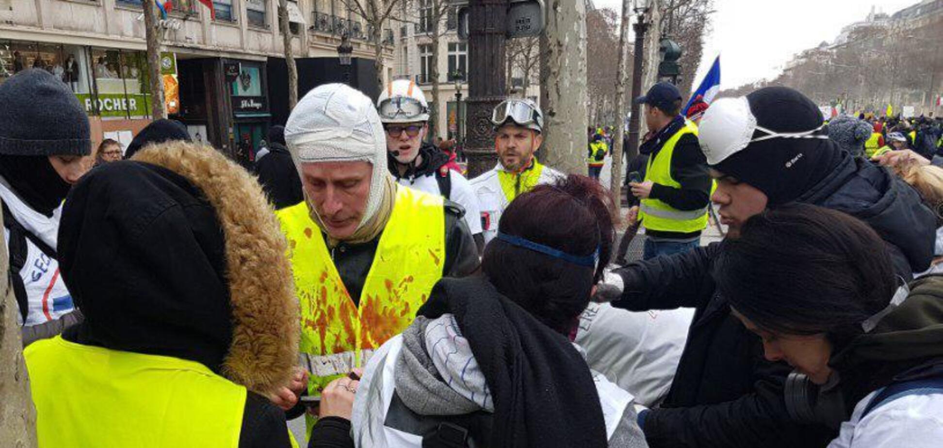 Оторванные руки, разбитые головы: в Париже полиция взялась за ''желтые жилеты''