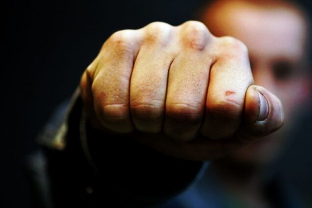 В Крыму незрячий инвалид плюнул в депутата Госдумы: тот его избил