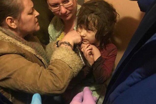 'Усе для неї роблю!' Мати дівчинки-мауглі з РФ шокувала зізнаннями