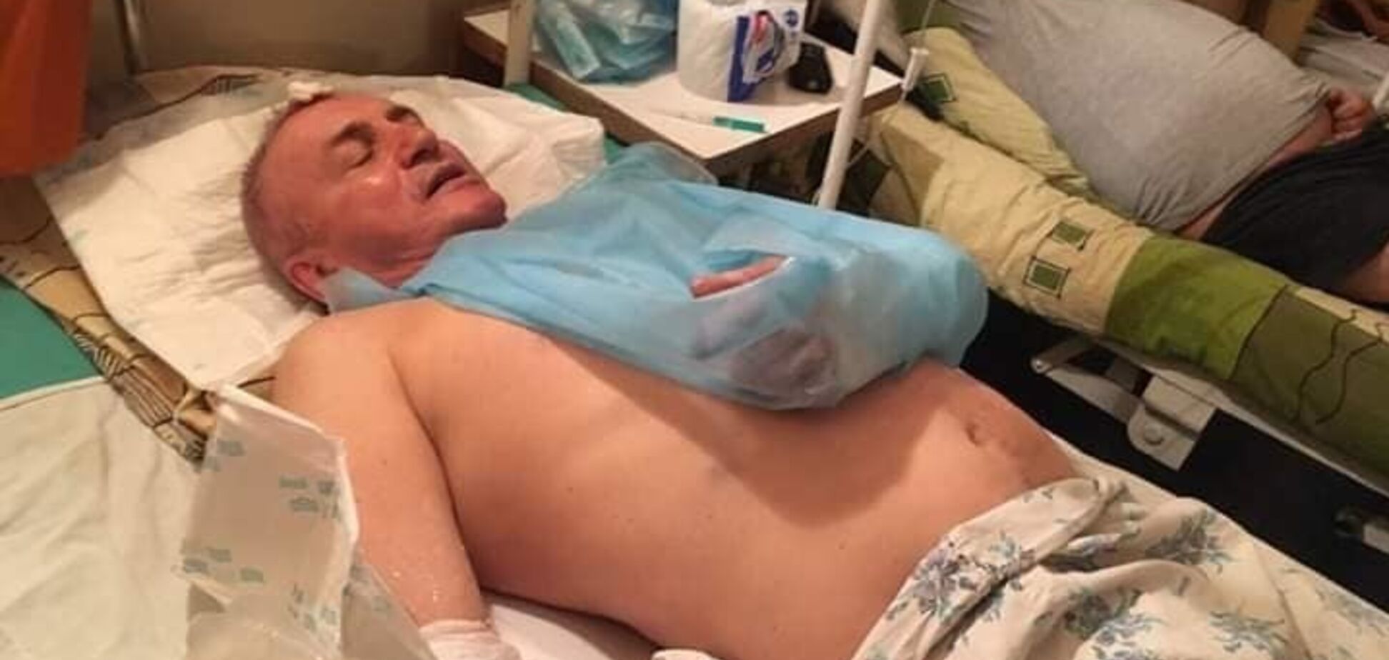 Восемь дырок в голове, сломаны руки и ноги: под Кривым Рогом жестоко поиздевались над строителями