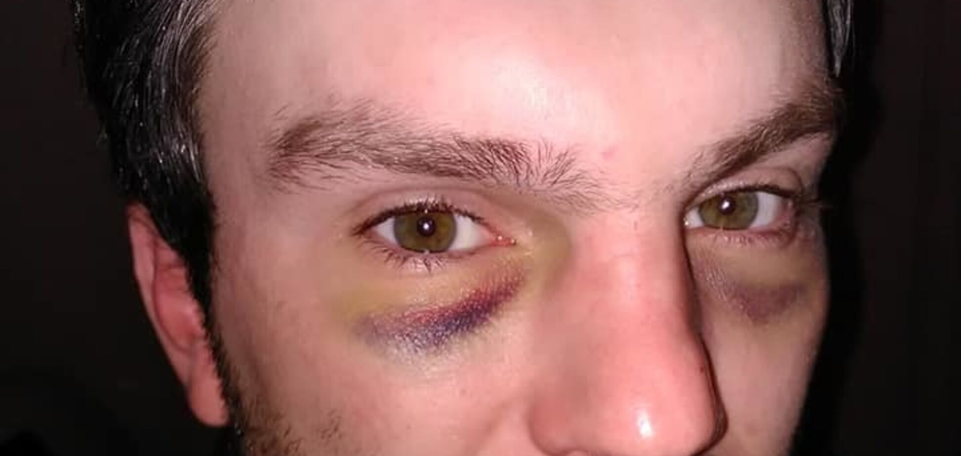 Новая бойня соседей: в многоэтажке Киева с ножом напали на семью