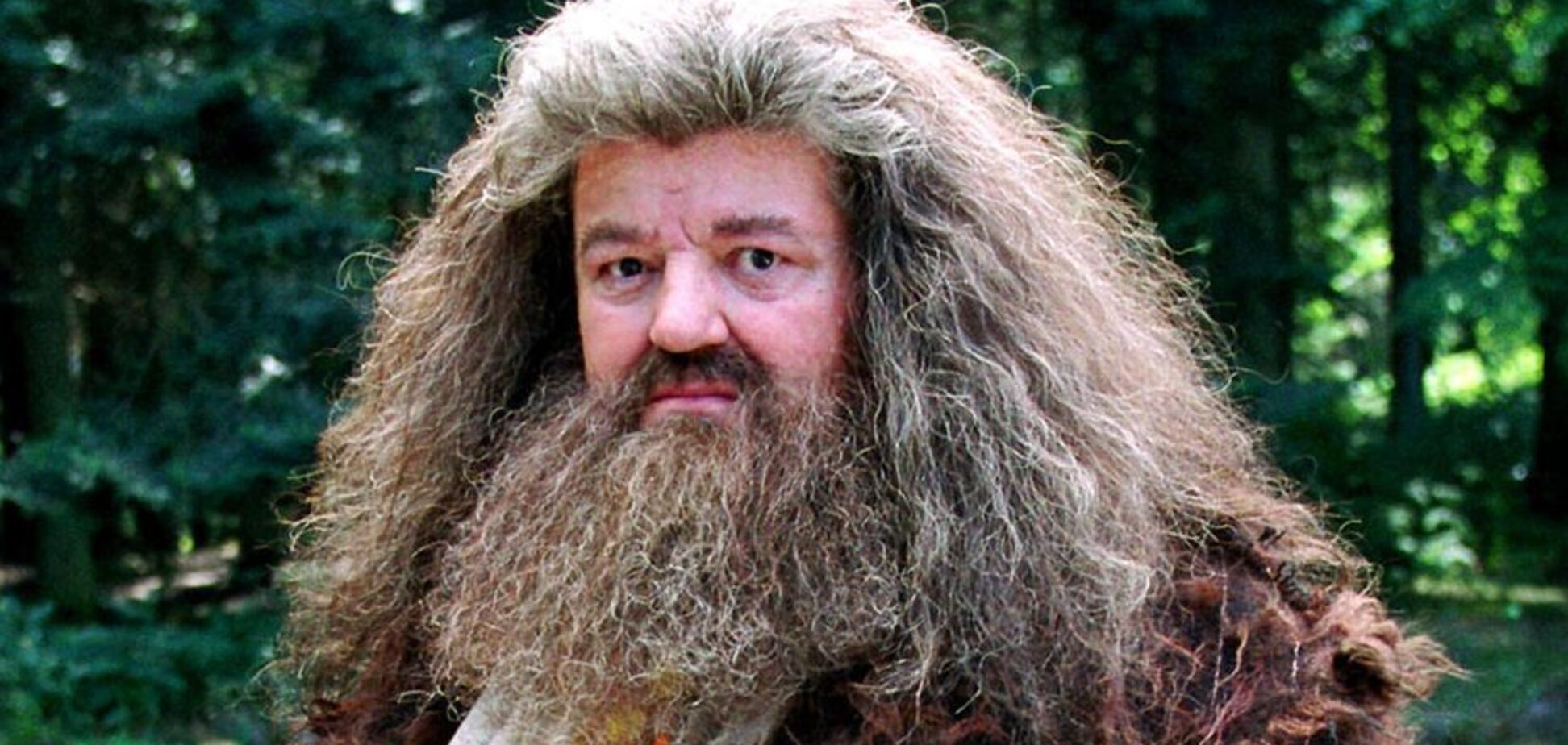 Всеми любимый актер из ''Гарри Поттера'' оказался в инвалидном кресле