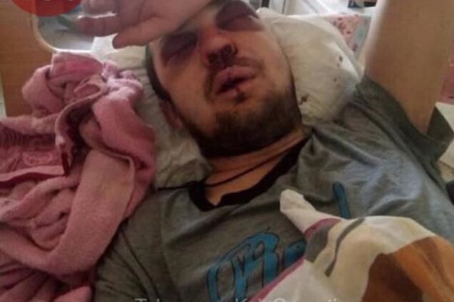 Попросив передати решту: в Києві водій маршрутки жорстоко побив пасажира