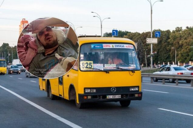 Разбита голова, сломана челюсть. Из-за 2 гривен водитель зверски избил пассажира в Киеве