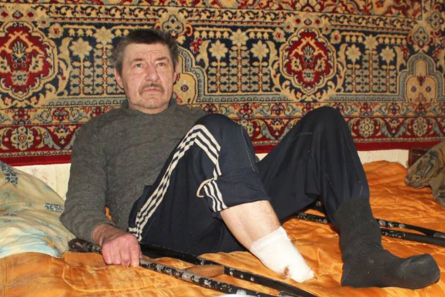 Відрізав ножем і скинув з моста: українець сам собі ампутував ногу