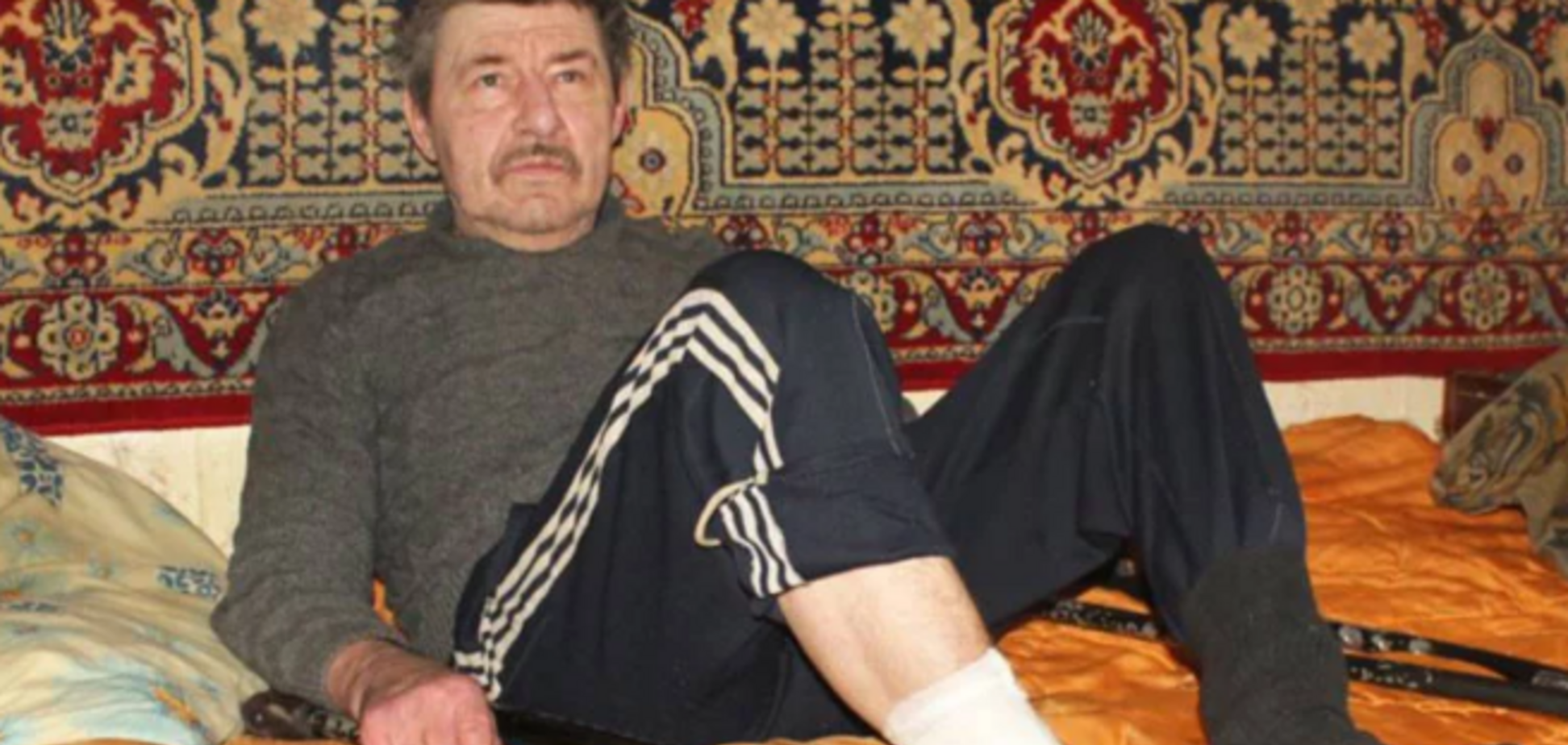 Отрезал ножом и скинул с моста: украинец сам себе ампутировал ногу 