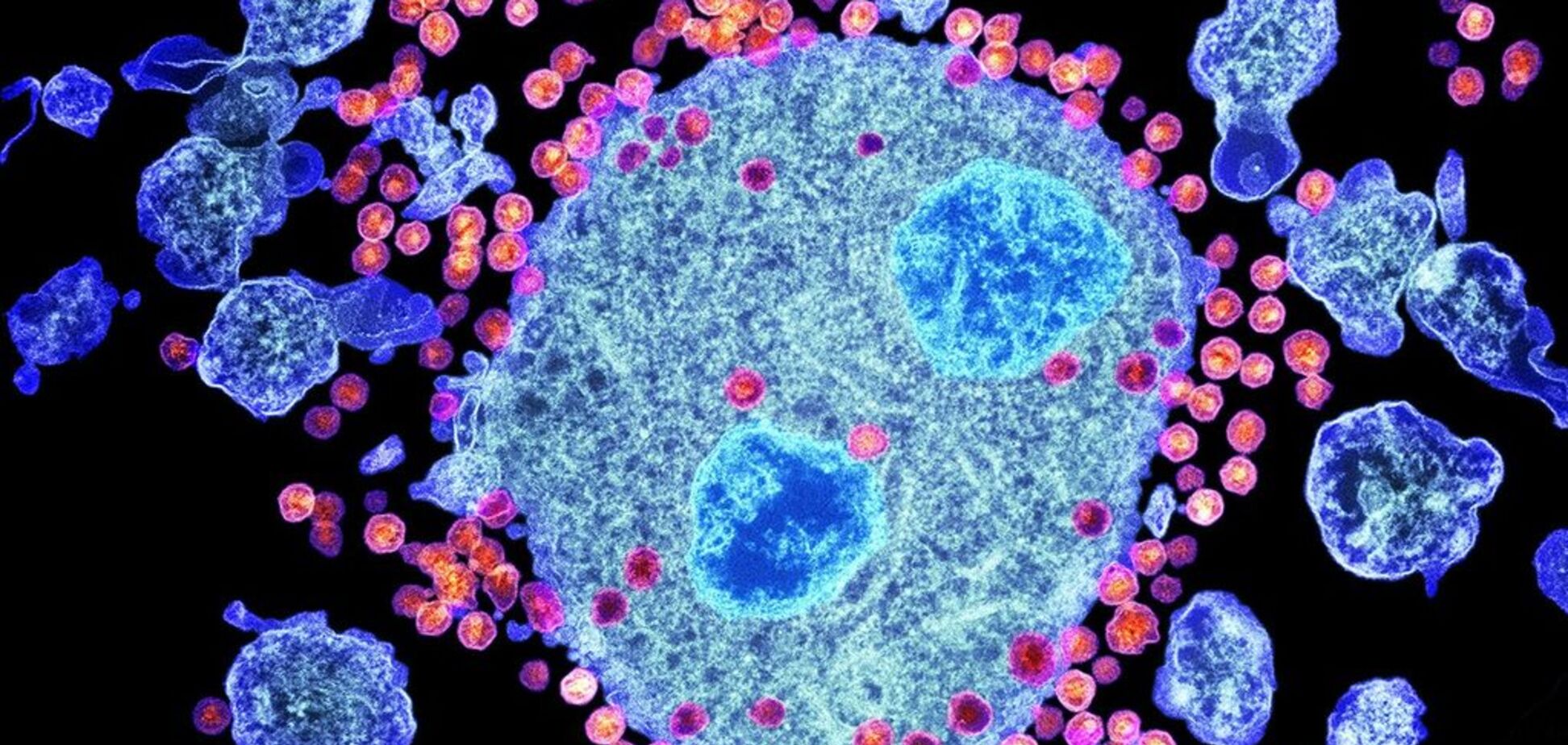 Очищает от ВИЧ: генетики создали уникальную молекулу