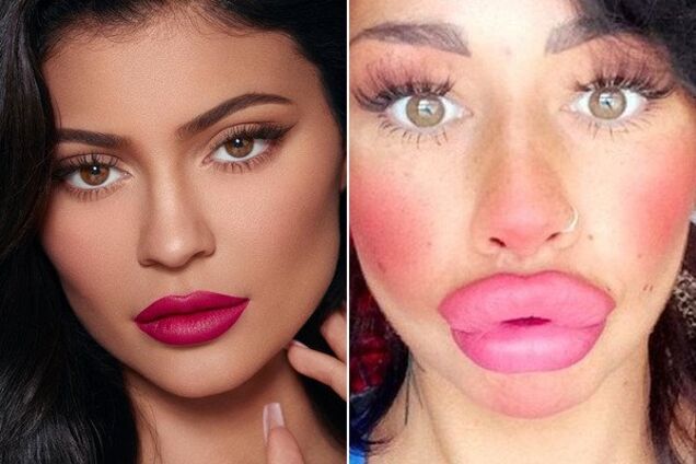Прощавайте, накачані губи: в світі набирає силу новий тренд