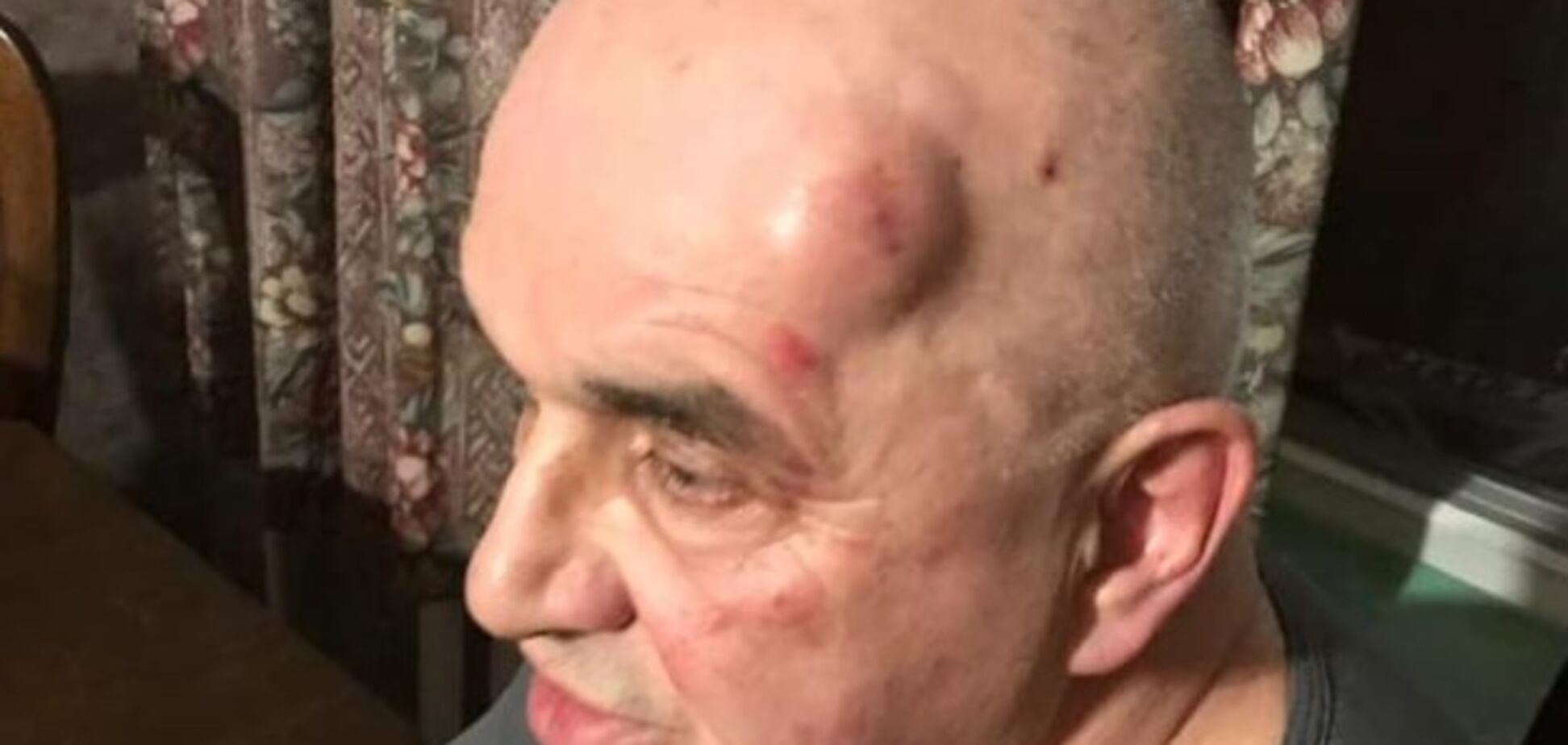 Люди в масках начали стрелять: в Запорожье напали на ''антимайдановца''