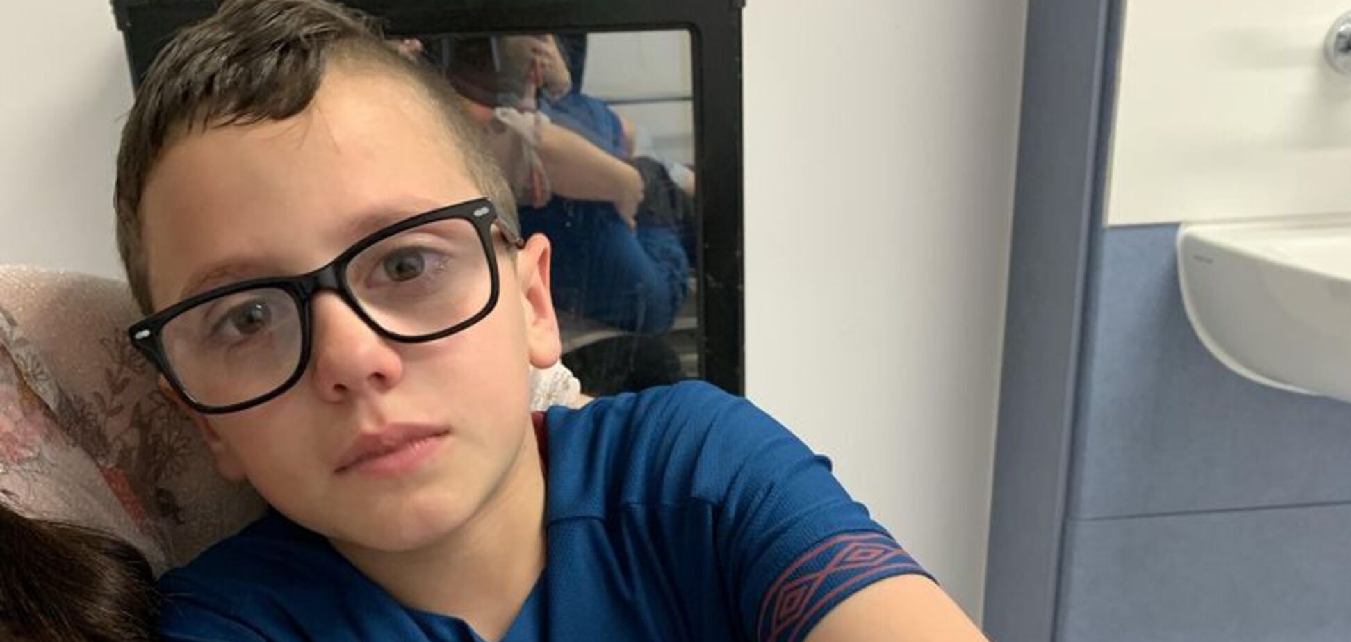Отруйний павук зробив дірку у нозі хлопчика у Британії: фото 18+