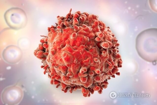 Раковые клетки