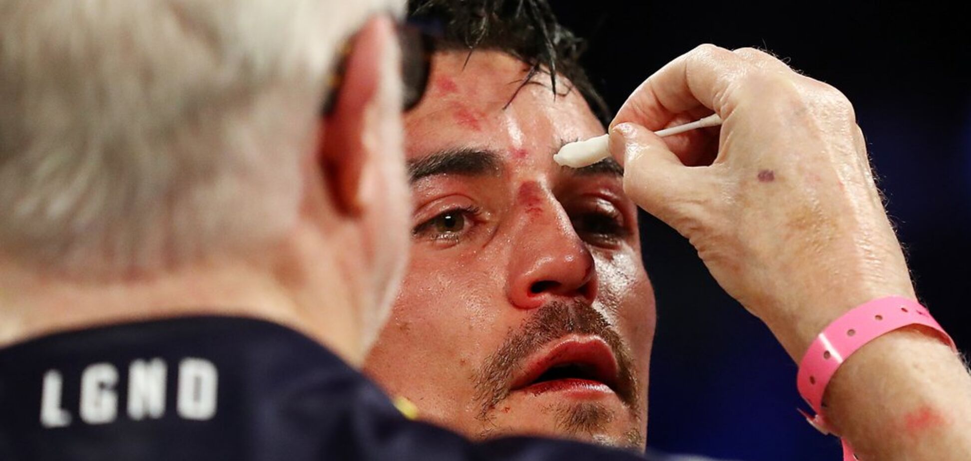 'Кошмар, жуткое чувство': жертва Ломаченко поделился откровениями о бое с украинцем