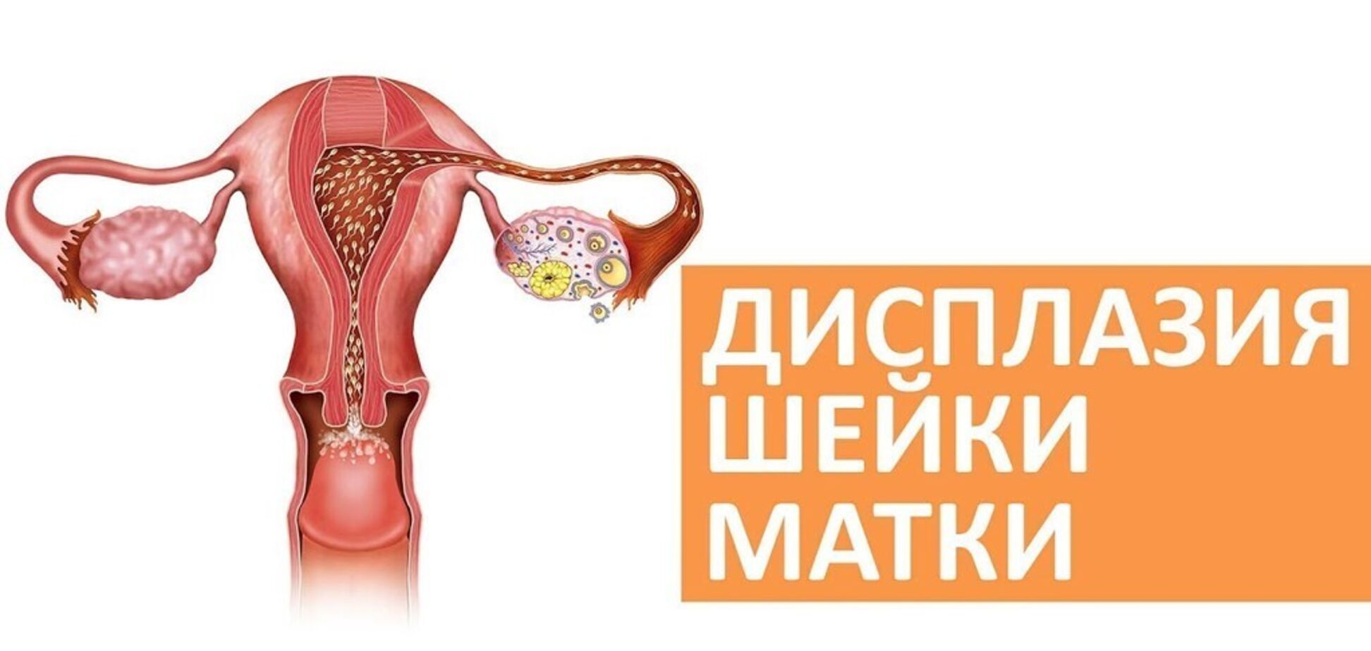 Почему папилломы и бородавки несут в себе скрытую угрозу для здоровья?