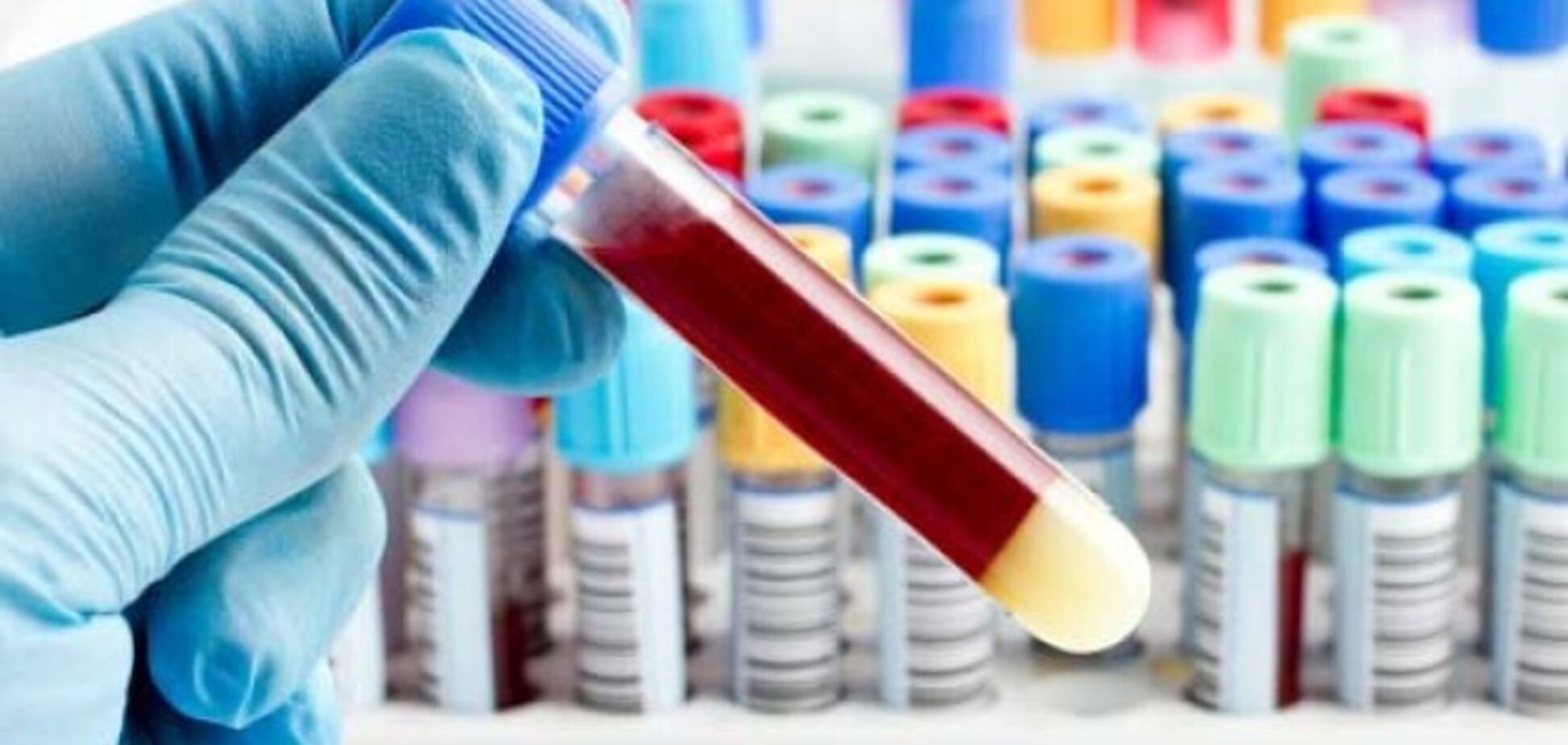 Порошенко vs Зеленский: нарколог раскрыл нюансы медосмотра кандидатов