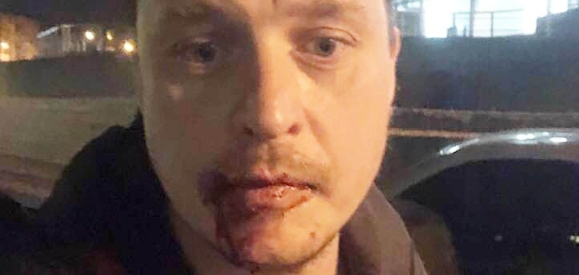 'Я люблю рашку!' В Киеве избили известного режиссера за замечание о русской музыке