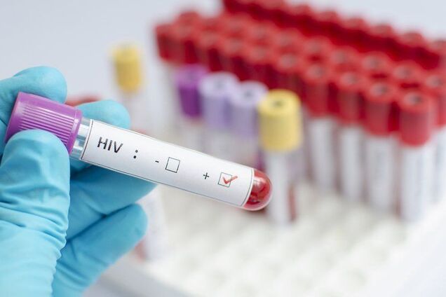 Революция в медицине: создан новый метод лечения ВИЧ 