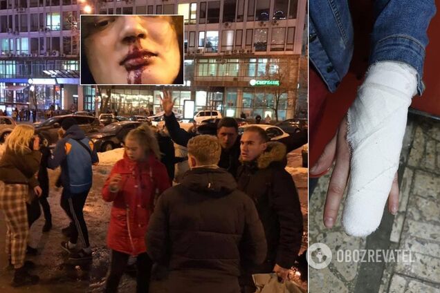 'Повалили на землю и пинали ногами': жестокие банды подростков устроили террор в Киеве