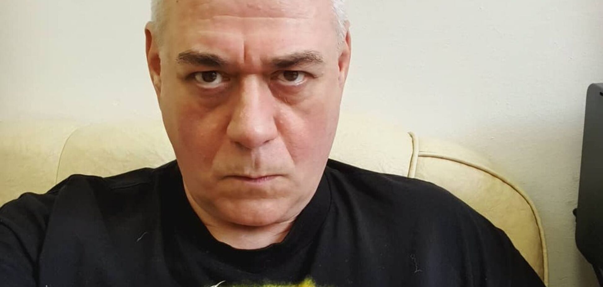 Аневризма аорти: чим хворів Доренко
