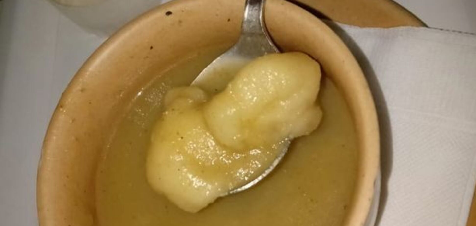 В больнице разыгрался скандал из-за окровавленного ватного тампона в супе