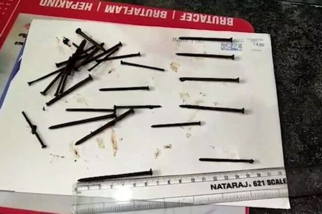 У мужчины из желудка извлекли 116 гвоздей