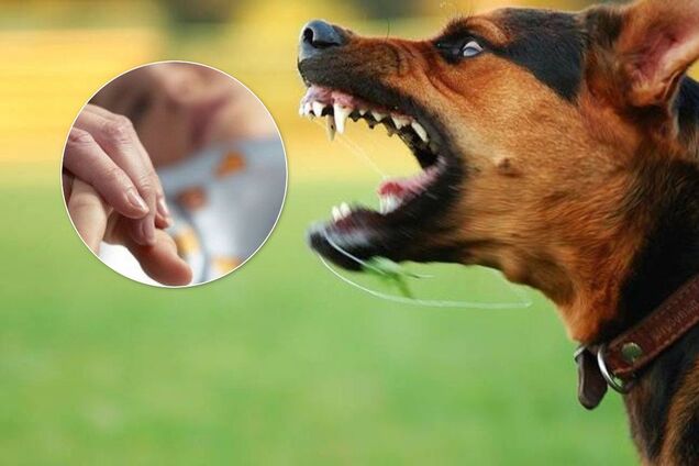 Нападение собак