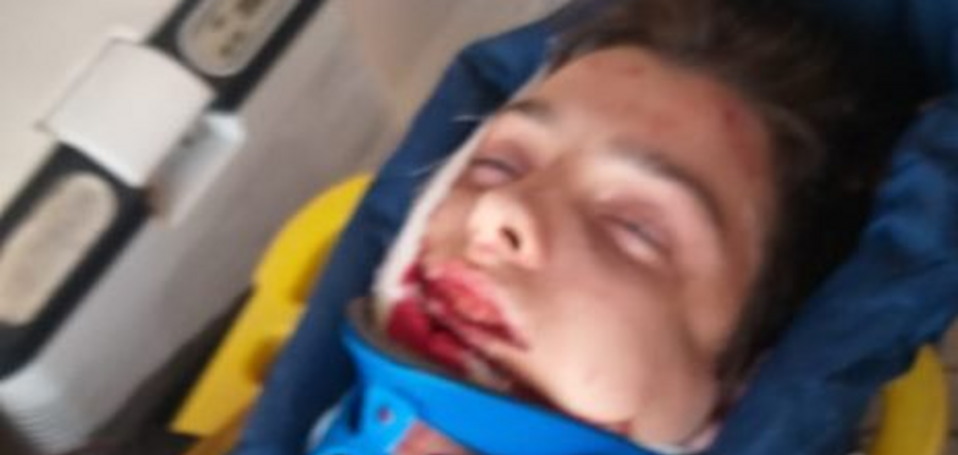 Зірвався з мосту: в Харкові сталася трагедія з підлітком