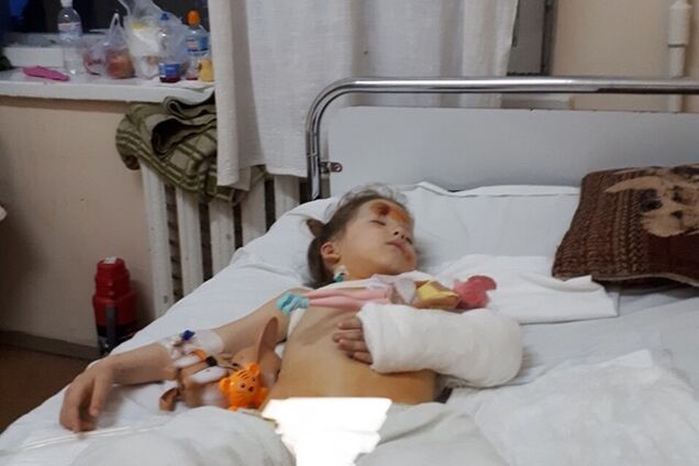 Вісім переломів і рвані рани: з'явилися моторошні подробиці про ДТП з 4-річною донькою екс-АТОвця